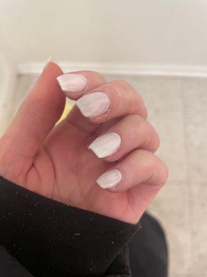 Full set acrylic