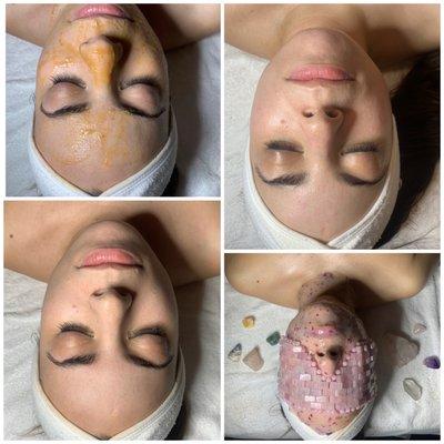 Facial process