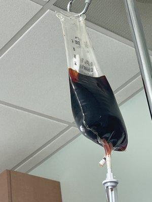 Iron infusion