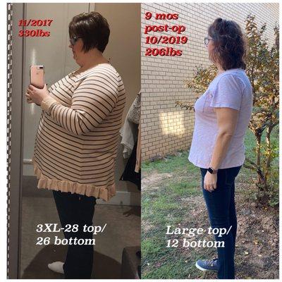 Weight loss results