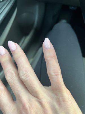 My pinky nail is crooked