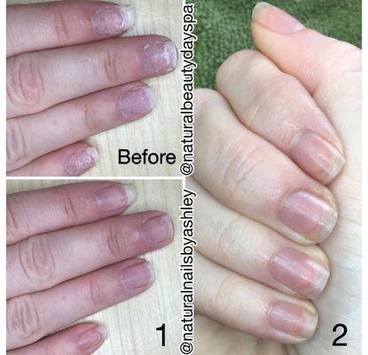 Results from IBX Nail Treatment. In just two treatments nails are transformed into strong healthy nails.