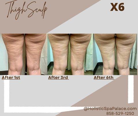 Cellulite reduction and skin tightening