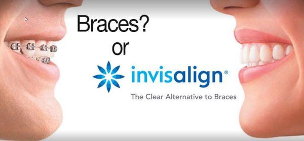 Invisalign