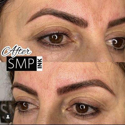 After Microblading