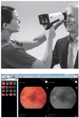 Excellent retinal imaging achieved by the Zeiss Visuscout 100 camera.