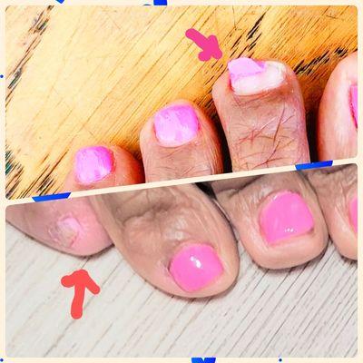 Gel polish peeling on the pinky toe with 24 hrs (bottom photo) Gel polish peeling with 4 days on a middle toe (top photo)