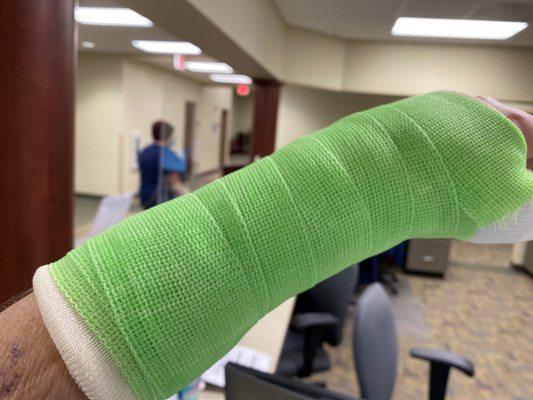 My new cast... in lime green ‍