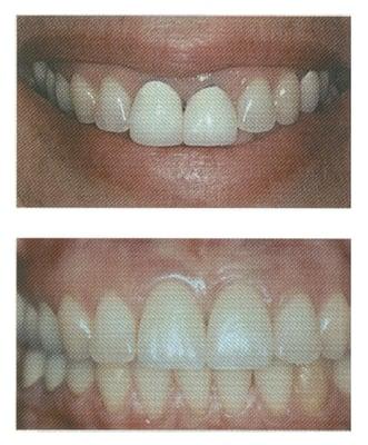 A great smile can make a big impression. www.rapidsmile.com