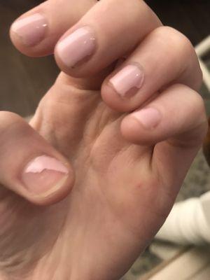 6 days after gel manicure