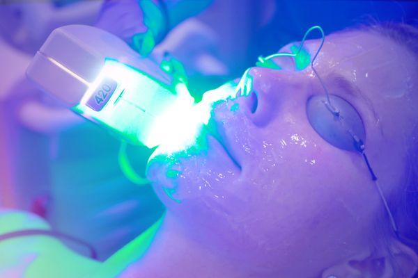 BroadBand Light Therapy (BBL) Laser for skin rejuvenation at Rejuva Medical Aesthetics.