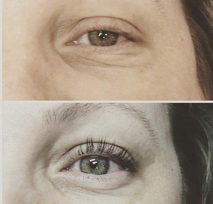 Lash lift