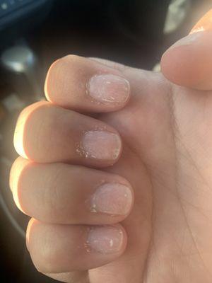 My crusty nails