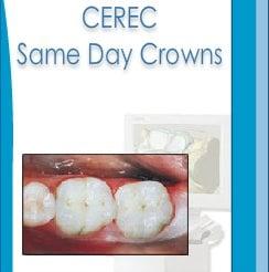 Chicago dentists, 60622 dentist, Cerec dentists, modern dentists, emergency dentists, same day dentists, east village dental