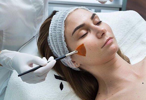 Chemical Peels for every skin type