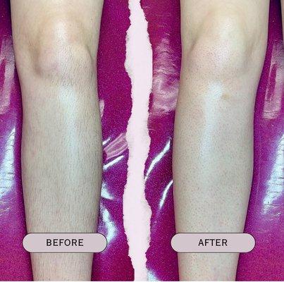 Women's Lower Leg Wax