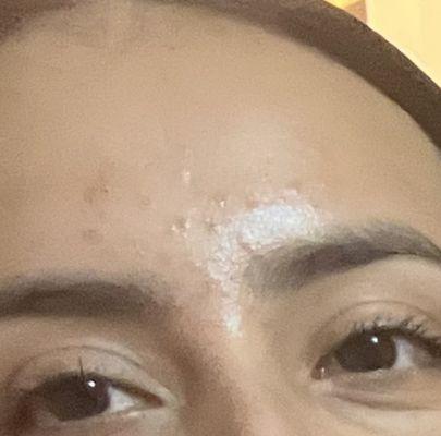 Irritating red bumps due to lack of proper hygiene practices at this location (the brow lady did NOT wash her hands before touching my face)