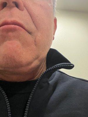 You want your neck to look like this, go to Heidari DO for your neck lift.