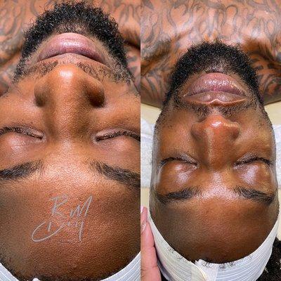 Gentlemen Marked Facial