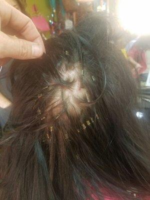 Damage from misplaced hair extensions at mane st junction showing hair loss