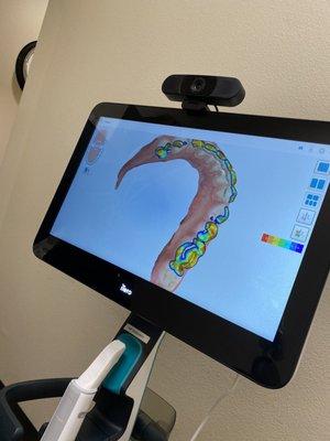 3D model scan of your mouth/teeth