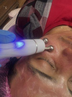 Tratamientos avanzados para tratar melasma .