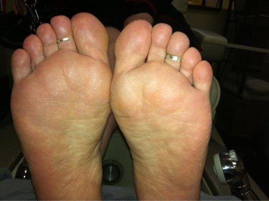 Results after one hour of a pedicure treatment!