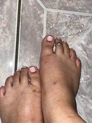 Gel pedicure