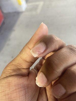 She pulled off a piece of acrylic and literally took my nail with it. That patch that you see there is SKIN! I have no nail there!