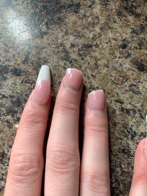 Nails peeling up And broken