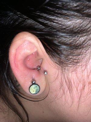 Anti tragus and tragus