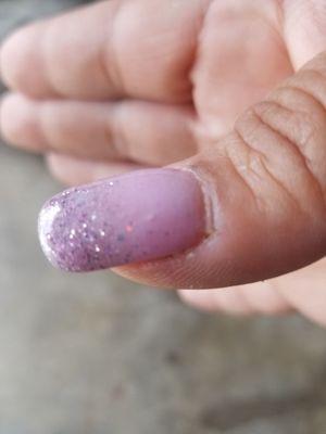 Dip powder nails, thick and lumpy. Look at the cuticles.