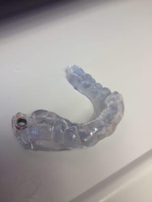 3d printing used to place the dental implant