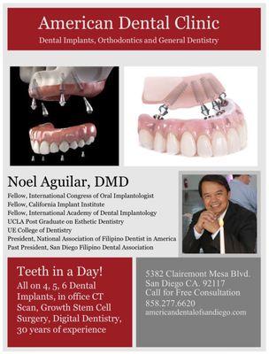 Full Arch Dental Implants