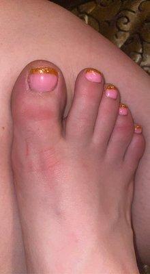 Badly painted. Notice the left side if big toe. Uneven coating