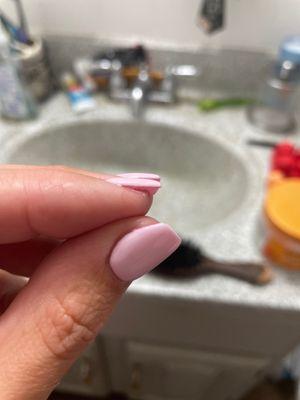 Glue on my skin from my nail