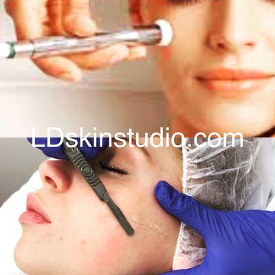 Microdermabrasion or Dermaplaning? Both remove dead skin cells which helps rejuvenation, product absorption, fine lines, dark spots.