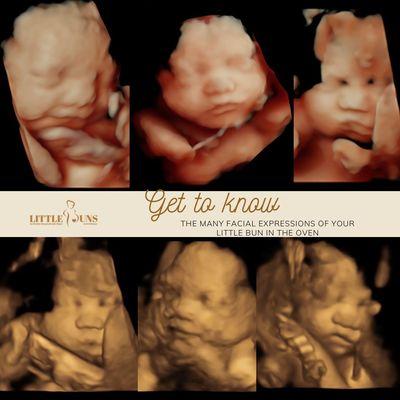 Little buns Scottsdale, where you can see your little one in a clear 3D, 4D, and 5D prenatal ultrasound!