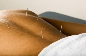 Acupuncture For Men's Health