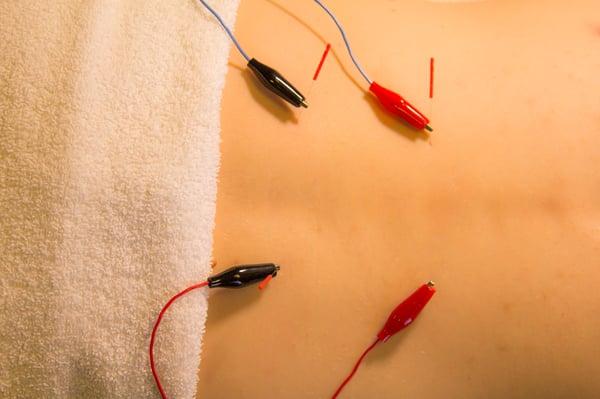 Electrostimulation is an effective way of healing from injury faster. You'll find the light pulse to be extremely relaxing.