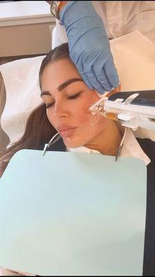 Platelet Rich Plasma (PRP) Facial PRP