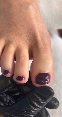 Pedi with toe nail correction.