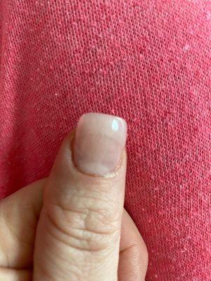 That's the one thumb....missing a section of cuticle that was cut off