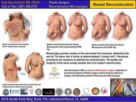 Breast Reconstruction Options