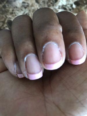 Fingernails