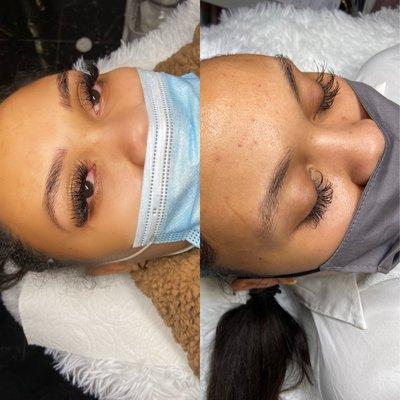 Microblading