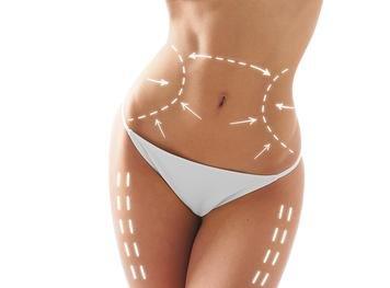 Body Contouring-Shaping with Cavi-Lipo, Laser Lipo, Zerona, Z-Wave, Far Infrared Wraps and RF Skin Tightening