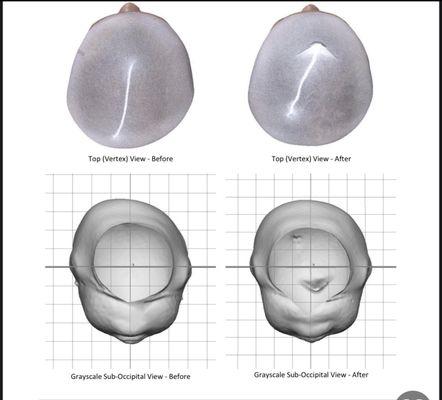 Imaging of head shape Before (left) and after (right)