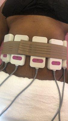 LASER LIPO