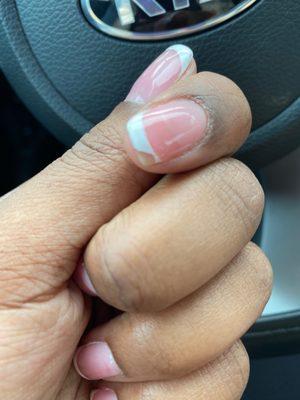 Chipped nail